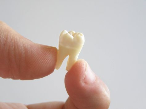 Here's why losing a back tooth could be more serious than you might think, in addition to some helpful advice on how a dental implant could prevent problems a missing tooth could cause. Wisdom Teeth Swelling, Tooth Extraction Aftercare, Tooth Extraction Healing, Teeth Diseases, Missing Tooth, Oral Surgeon, Emergency Dentist, Teeth Implants, Tooth Extraction