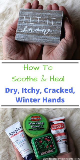 How To Soothe & Heal Dry, Itchy, Cracked, Winter Hands #skincare #dryskin Cracked Finger Tips, Dry Cracked Hands Remedy, Cracked Hands Remedy, Hand Remedies, Dry Hands Remedy, Dry Patchy Skin, Extremely Dry Hands, Itchy Hands, Dry Hand Skin