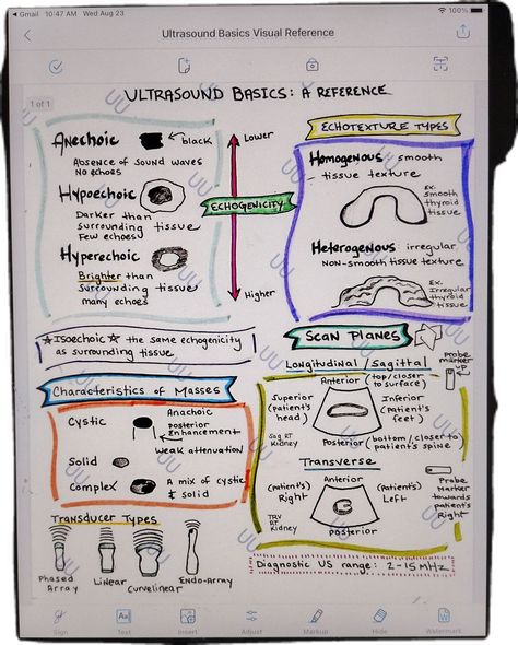 Handwritten Ultrasound Basics Visual Reference. 1 page    Geared towards new DMS Sonography students/anyone just starting to learn about ultrasound. Covers types of echogenicity, echotexture types, characteristics of masses, scan planes, transducer types, and the range for diagnostic ultrasound (a common class test and registry question!). This is a PDF ready to be downloaded to your device.  I don't accept returns, exchanges, or cancellations.  But please contact me if you have any problems wit Cardiovascular Sonography Student, Obgyn Ultrasound Tech, Ultrasound Tech Student, Cardiac Sonography Student, Sonography Notes, Sonography Student Study, Pediatric Sonography, Ultrasound Aesthetic, Pediatric Ultrasound