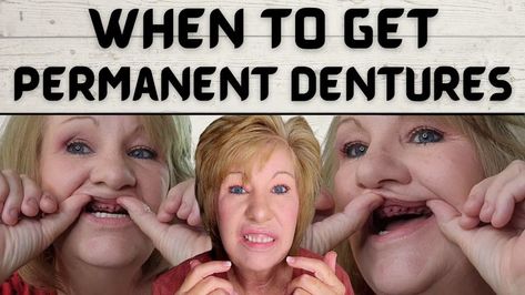 How Soon Should You Get Permanent Dentures Dentures Tips, Dentures Before And After Immediate, How To Make Dentures At Home, Denture Sure Fit, Wearing Dentures Tips, Permanent Dentures, Removable Partial Denture, Denture Repairs, Affordable Dentures