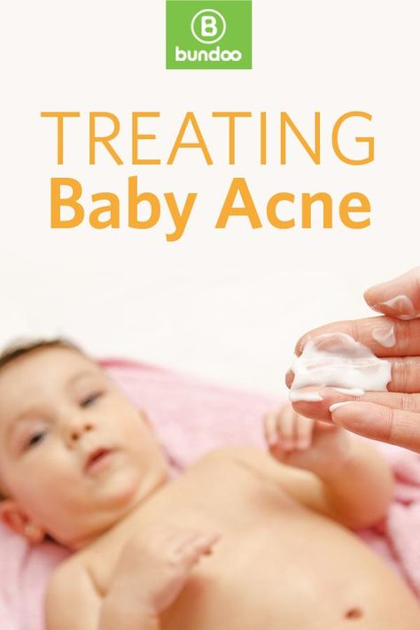 What really works for baby acne? Baby Acne Remedy, Newborn Acne, Acne Remedy, Baby Acne, Baby Guide, Baby Ruth, Super Healthy Kids, Newborn Photo Shoot, Real Parents