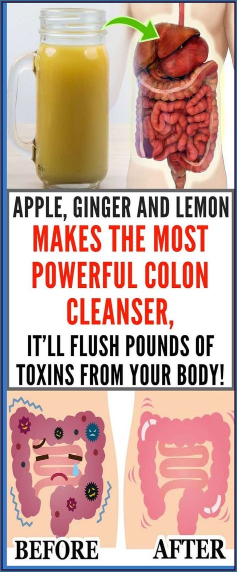 Apple, Ginger And Lemon Makes the Most Powerful Colon Cleanser, It�ll Flush Pounds Of Toxins! Apple Cider Vinegar Detox Drink, Ginger And Lemon, Turmeric Water, Apple Cider Vinegar Detox, Natural Colon Cleanse, Detox Drinks Recipes, Ginger Juice, Egg Diet, Turmeric Benefits