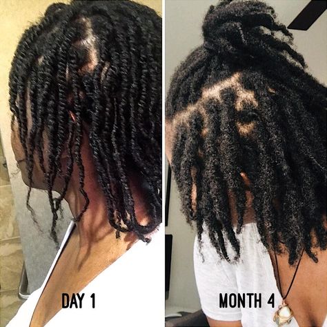 Loc Progress, Loc Goddess, Patience Love, Change Day, Short Locs, Micro Locs, Beautiful Locs, Day Pictures, Starter Locs