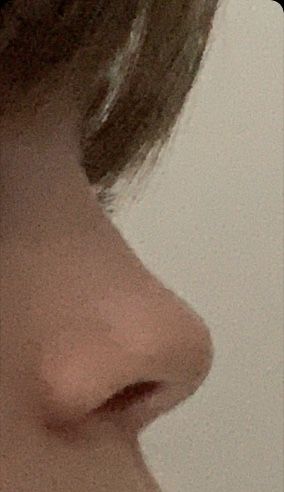 Nose Aesthetic, Upturned Nose, Haircut For Face Shape, Straight Nose, Pretty Nose, Perfect Nose, Small Nose, Button Nose, Nose Shapes