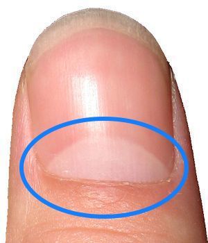 The matrix is the area just below the cuticle from which nail cells are formed. Damage to the matrix will cause damage to the forming nail plate cells. The white half moon shape is the lanula, this may or may not be visible on all nails. Nail Structure, Layers Of The Epidermis, Nail Beds, Half Moons, Diy Hair Care, Nail Plate, Skin Pores, Moon Shape, The Matrix