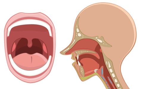 enlarged-tonsils.gif (487×311) Donald Duck, Anatomy, Gif, Disney Characters, Disney, Fictional Characters, Quick Saves