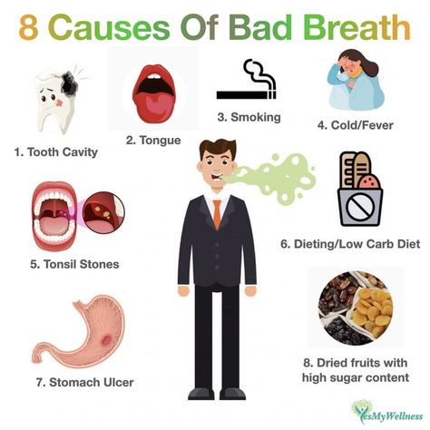 Most of the time we don’t realise we have bad breath. It can be due to : 1. Tongue : Main cause. Brush your tongue with toothbrush or a tongue brush. Regular gargling with mouthwash helps too. 2. Going on a low carb diet : Body will burn fat, producing ketones and this causes our mouth to ‘smell’. 3. Stomach ulcer : Stomach ulcer alone won’t cause bad breath but the resulting bacteria H Pilori, will cause bad breath. 4. Tonsil stones : This whitish lump is formed from bacteria, leftover food. #badbreathcures Bad Smell From Mouth, Tongue Brush, Causes Of Bad Breath, Prevent Bad Breath, Tooth Cavity, Leftover Food, Bad Breath Remedy, Stomach Ulcers, Nursing Tips