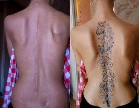 15 Tattoos That Brilliantly Cover Up Peoples Embarrassing Scars - Wow Gallery Mastectomy Scar Tattoo, Tattoo Over Scar, 16 Tattoo, Scar Cover Up, Tattoos To Cover Scars, Scar Tattoo, Tattoo Zeichnungen, Tattoo Cover, Tattoo Cover-up