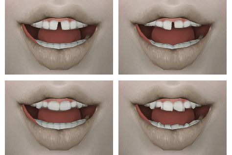 Sims 4 Cc Teeth, Sims 4 Teeth Cc, Ts4 Lookbook, Sims Design, Ts4 Mods, My Files, Sims 4 Cas Mods, The Sims 4 Skin, Nuh Uh