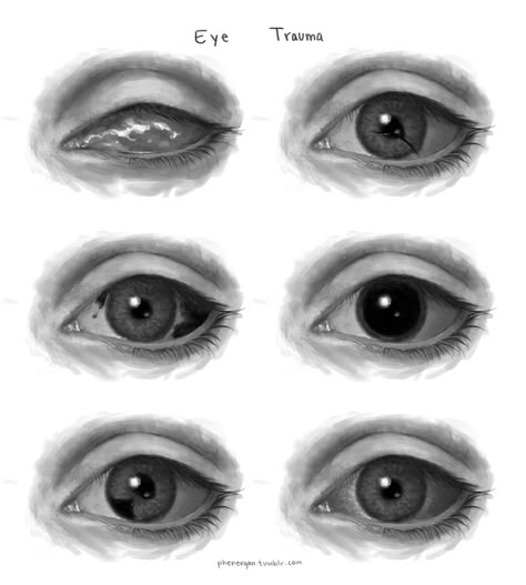 "Eyes" illustrations by DeviantArt user "God-Head" #eyes #illustration #reference #drawing Blind Eyes Drawing Reference, Blind Eyes Art, How To Draw Blind Eyes, High Eyes Drawing, Blind Eyes Drawing, Eyes Illustration, Eye Scar, Blurry Eyes, Books Drawing