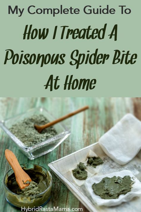 Spider bites are definitely cause for alarm, especially when they are the poisonous kind. However, not every single one warrants a trip to the ER. Learn how Hybrid Rasta Mama tackled a spider bite at home using some simple remedies. #spiderbite #spiders #toxins #clay Spider Bites Remedies, Brown Recluse Spider Bite Stages, Treating Spider Bites, Spider Bites Pictures, Recluse Spider Bite, Brown Recluse Spider Bite, Hobo Spider, Home Remedies For Spiders, Poisonous Spiders