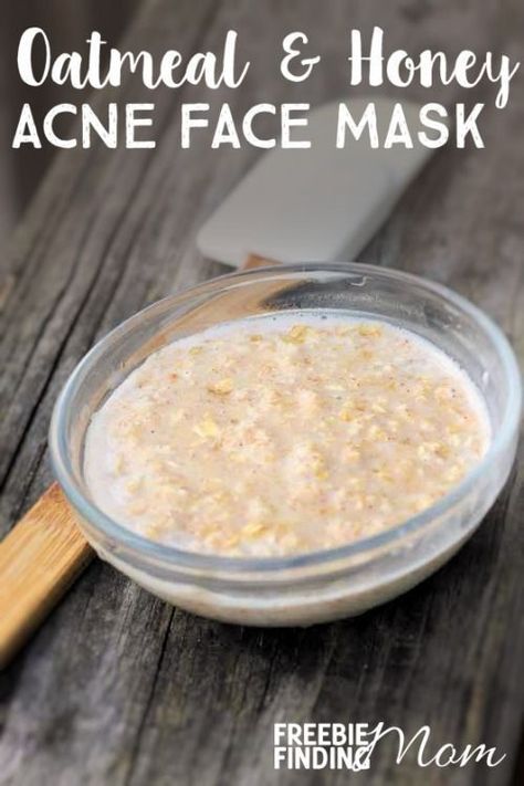 Oatmeal Honey Face Mask, Oats And Honey Face Mask, Acne Face Mask Homemade, Honey And Yogurt, Beauty Face Mask, Honey For Acne, Acne Face Mask, Acne Face, Open Pores