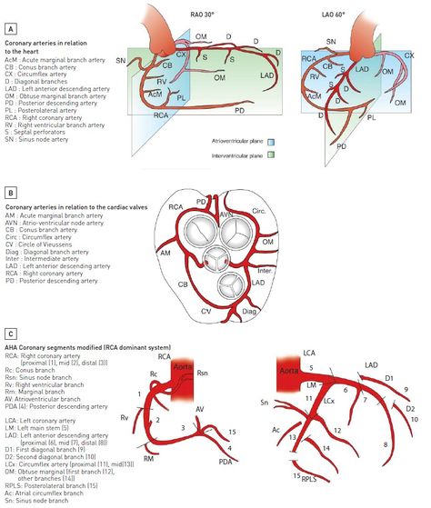 Percutaneous interventional cardiovascular medicine - Invasive diagnostic coronary angiography Surgery Motivation, Coronary Angiography, Cath Lab Nursing, Cardiac Cath, Cardiac Anatomy, Cardiac Sonography, Interventional Cardiology, Cardiovascular Disorders, Medicine Notes