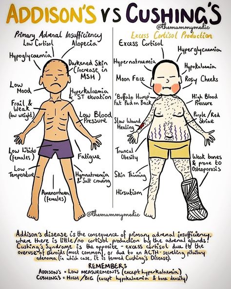 usmlestep1 on Instagram: “Addison’s vs Cushing’s #usmlestep_1” Addison And Cushing Disease, Addison Vs Cushings, Addisons Vs Cushings, Concept Maps Nursing Student, Pharm Notes, Rule Of Nines, Cushing Syndrome, Ipad Productivity, Nursing School Studying Cheat Sheets