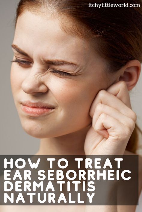 Itchy Ears Remedies, Dry Scaly Skin, Itchy Ears, Itching Skin, Healthy Happy Life, Dry Skin Remedies, Take Care Of Your Skin, Scaly Skin, Dry Itchy Skin