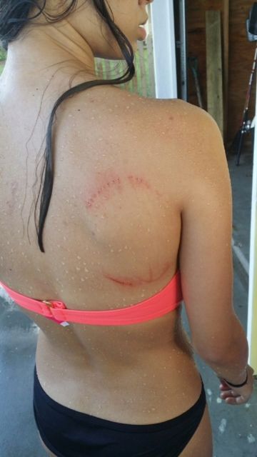 Bellaire teen may be shark-bite victim - stay away from schooling fish in Galveston! Close Calls, Shark Bites, Time Life, Lucky Day, Viral Trend, Bloopers, Pin Up, Funny Pictures, Humor