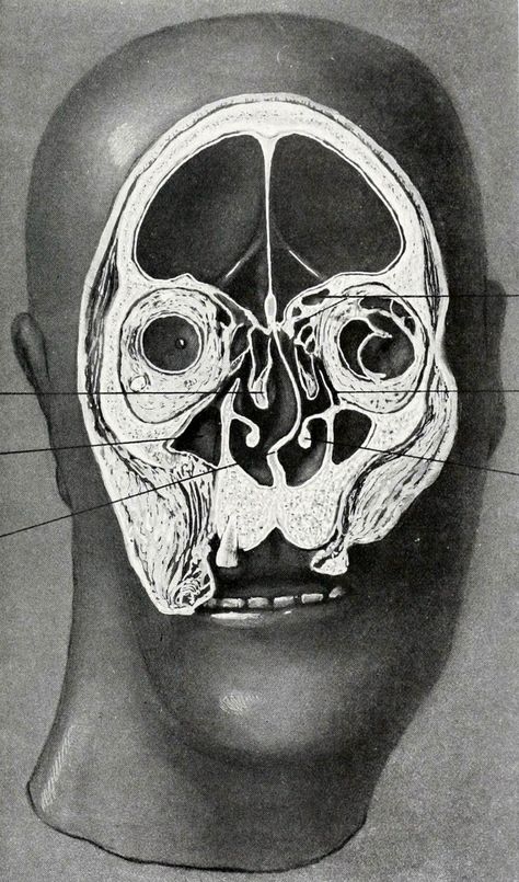 Structural anatomy of the human head. Successive frontal slices of adult male, brain removed - 3/7. Studies in the Anatomy and Surgery of the Nose and Ear. Adam E. Smith, 1918. Human Head, Arte Inspo, Anatomy Drawing, Scientific Illustration, Medical Illustration, Ap Art, Anatomy Reference, Anatomy Art, Human Anatomy