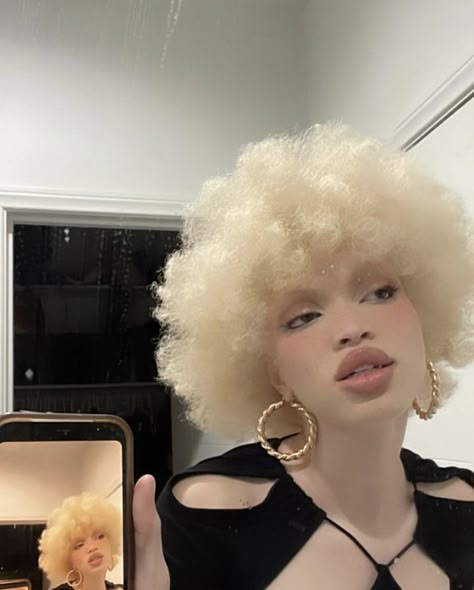 Pretty Albino Girl, November To Remember, Hair Color Brunette, Albino Girl, Sun Kissed Hair, Black Femininity, African People, Aesthetic People, Hair Reference