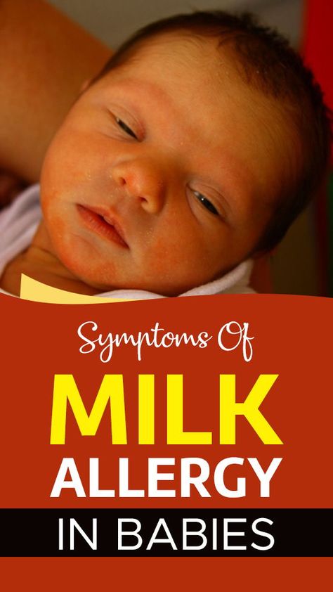 Lactose Intolerance Vs Milk Allergy In Babies: Why Your Child Is Reacting To Milk #newborn #motherhood #milkallergy #babies #babyhealth #parneting parnets Milk Allergy Baby, Breastfed Baby Poop, Cows Milk Allergy, Lactose Intolerance, Healthy Book, Lactose Free Milk, Milk Allergy, Unborn Baby, Breastfed Baby