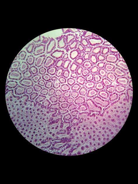 Simple epithelial cell of kidney. Tubule under microscope , #Affiliate, #cell, #epithelial, #Simple, #microscope, #Tubule #ad Microscopic Cells Biology Art, Cell Microscope Art, Cells Through Microscope, Human Cells Under Microscope, Cells Under Microscope Art, Human Cells Microscope, Cells Aesthetic Biology, Under The Microscope Art, Skin Cells Microscope