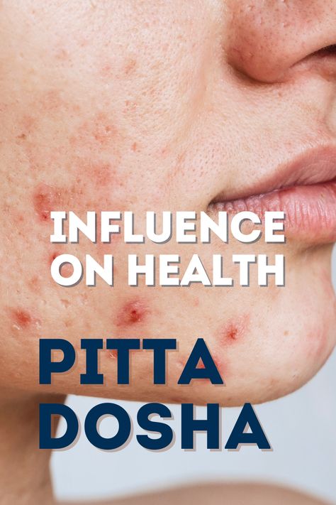 The a high or excessive pitta significantly impacts an individual’s health and personality traits, particularly when it becomes excessive.

Health Problems Associated with Excess Pitta: An imbalance in pitta can lead to skin diseases and various digestive issues. Common skin problems include acne, rashes, and inflammation.
Medical Conditions Related to High Pitta: High Pitta can cause Skin rashes and digestive issues such as acid reflux, heartburn, and ulcers Pitta Diet, Ayurveda Dosha, Positive Personality Traits, Yoga Blog, Ayurvedic Practitioner, Core Strengthening Exercises, Skin Rashes, Online Yoga Classes, Digestive Issues