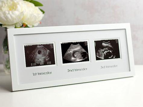 Sonogram Picture Frame, Baby Sonogram, Pregnancy Announcement Pictures, Sonogram Pictures, Expecting Mother Gifts, Gender Neutral Baby Nursery, Baby Picture Frames, Baby Photo Frames, Pregnancy Milestones