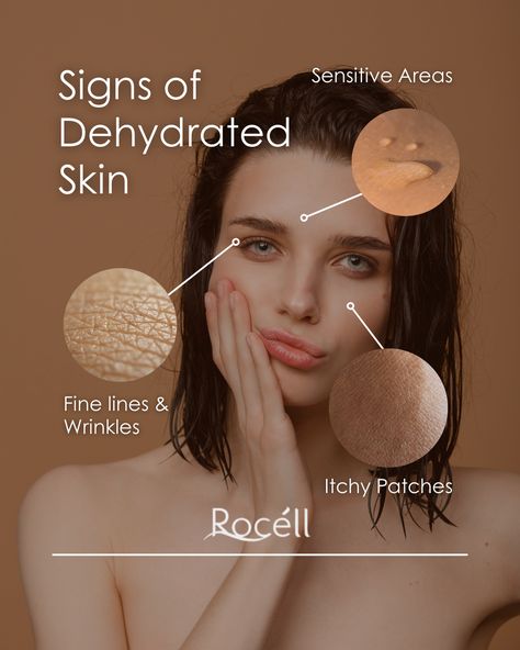 ✨ Signs of Dehydrated Skin 💧  -Fine lines & wrinkles: More pronounced due to lack of moisture     -Sensitive areas: Skin becomes easily irritated    -Itchy patches: Dry, flaky spots that feel uncomfortable     #HydrateYourSkin #DehydratedSkin #SkincareTips Women Skin, Beauty Products Photography, Derma Roller, Skin Clinic, Itchy Skin, Dehydrated Skin, Skin Tips, Instagram Post Template, Dermatology