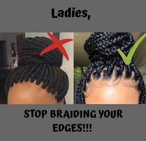 Box Braids Bra Strap Length, Braids Sizes, Box Braids Sizes, Braids With Shaved Sides, Shaved Side Hairstyles, Dutch Braid Hairstyles, Blonde Box Braids, Hair Braider, Short Box Braids