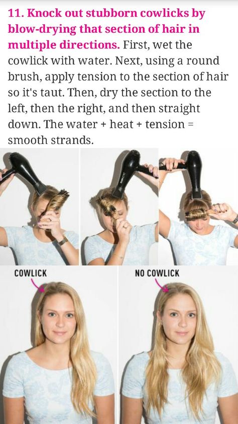 Never heard of cowlicks 😕 How To Style Hair With Cowlicks, Cow Lick Hair How To Get Rid, Cowlicks Front Of Head, Hairstyles For Cowlicks, Front Cowlick Hairstyles Women, Cowlick Hairstyles Women, Cow Lick Hairstyles, Bangs For Cowlicks, Cowlick Bangs