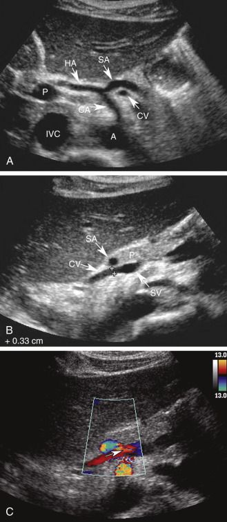 Sonography Humor, Ultrasound Humor, Future Sonographer, Ultrasound Anatomy, Abdomen Ultrasound, Ultrasound Notes, Vascular Anatomy, Medical Sonography Student, Diagnostic Medical Sonography Student