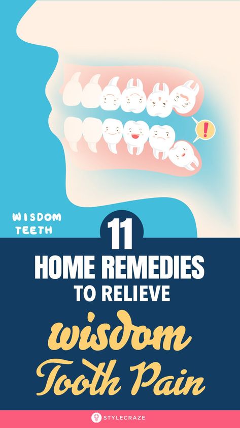 Home Remedies For Cavities, Wisdom Teeth Pain Relief, Toothache Relief, Tooth Pain Remedies, Wisdom Teeth Pain, Tooth Ache Relief, Remedies For Tooth Ache, Wisdom Tooth, Pain Relief Remedies