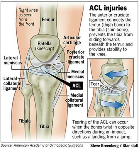 Acl Recovery, Acl Tear, Cruciate Ligament, Musculoskeletal System, Human Anatomy And Physiology, Muscle Anatomy, Knee Pain Relief, Medical Anatomy, Anatomy Physiology