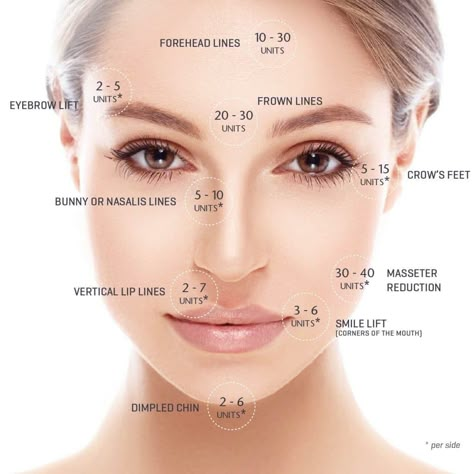 Botox unit amounts per area. #botox Botox Injection Sites, Botox Before And After, Botox Lips, Anti Wrinkle Injections, Botox Cosmetic, Botox Face, Facial Fillers, Anti Wrinkle Treatments, Cosmetic Injectables