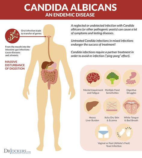 heal candida, 5 Crucial Steps to Heal Candida Naturally Yeast Infection During Pregnancy, Yeast Infection Symptoms, Food Sensitivity, Functional Health, Candida Cleanse, Candida Overgrowth, Candida Albicans, Candida Diet, Dry Itchy Skin