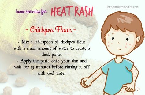 31 Home Remedies For Heat Rash On Face, Neck, Arms And Legs Remedies For Heat Rash, Heat Rash On Face, Rash On Face, Heat Rash, Handmade Ideas, Natural Oils, Home Remedies, Heat, How To Apply