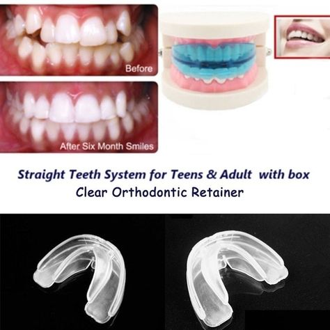 Straighten Teeth Without Braces, Crooked Teeth, Teeth Straightening, Straight Teeth, Orthodontics Braces, Teeth Braces, Front Teeth, Best Teeth Whitening, Teeth Care