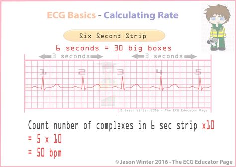 There are several methods for determining heart rate. Our first method is simple. Count the number of QRS complexes over a 6 second interval. Multiply by 10 to determine heart rate. This method works well for both regular and irregular rhythms. In the first image, we can count 5 QRS complexes, so the heart rate is 50. #MedStudent #EKG #Basics #HeartRate #Calculate #Rate #ECGEducator Pr Interval, Paramedic School, Pa School, Cardiac Nursing, Nursing School Survival, Respiratory Therapy, School Survival, Med Student, Nursing Notes