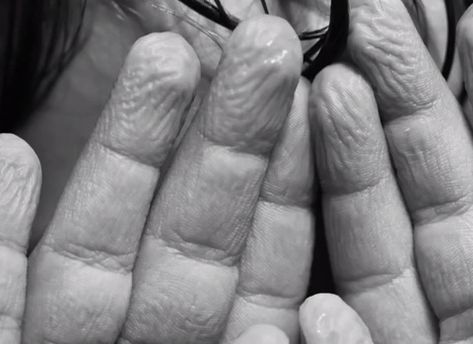 Perform an experiment to determine whether smooth or wrinkled fingers are better at holding wet objects. Peripheral Nervous System, Peripheral Nerve, Biology Lessons, About Science, Sweat Gland, Medical Tests, Body Photography, Medicine Journal, Free Lesson Plans