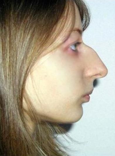 normal noses - Google Search Hooked Nose, Big Nose Beauty, Jewish Girl, Peter The Great, Anatomy Poses, Stage Makeup, Big Noses, Hair Reference, Face Hair