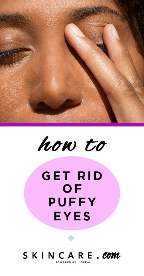 If you experience puffy-eyes, than you know how stubborn they can be to get rid of. We're helping you navigate exactly why you might be experiencing puffy eyes, and how you can reduce their appearance quickly. Plus, we're sharing some of our favorite products for the job! Puffy Eyelids How To Get Rid Of, How To Get Rid Of Puffy Eyes, Puffy Eyelids, Green Tea Mask, Women Health Care, Itchy Eyes, Alcohol Free Toner, Puffy Eyes, Colorful Eyeshadow