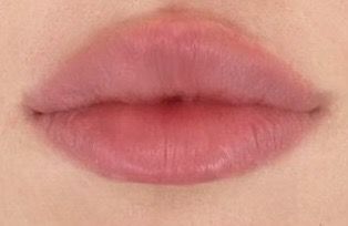 Non Cupids Bow Lips, Lips No Cupid, Round Lip Filler Shape, Round Cupids Bow Lips Aesthetic, Bambi Lips, Lip Claims For Dr, Round Lips Aesthetic, Round Top Lip, Heavy Upper Lip