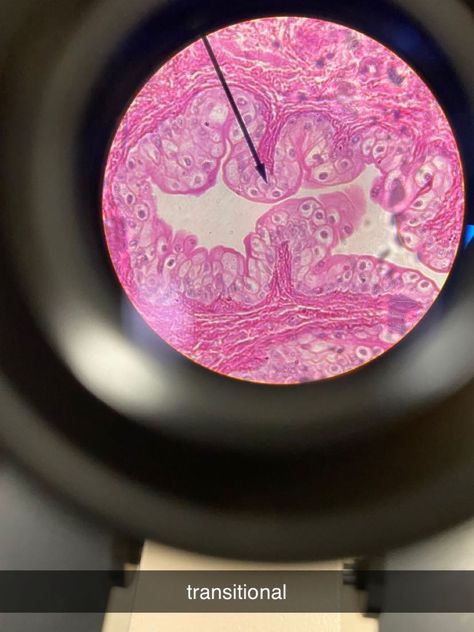 This tissue can be found in the lining of the bladder, uterers and urethra. The lining of the tissue is rounded which allows the identification of transitional epithelium tissue. Epithelium Tissue, Transitional Epithelium, Anatomy And Physiology, Biology, Music Record, Music Instruments