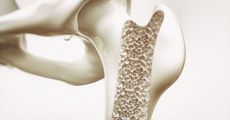 These Top 5 Bone Supplements Can Help Strengthen Bones Better than Calcium Alone | Top 5 Supplements Weak Bones, Low Bone Density, Bone Strengthening, Bone Fracture, Calcium Supplements, Bone Strength, Bone Loss, Strong Bones, Good Bones