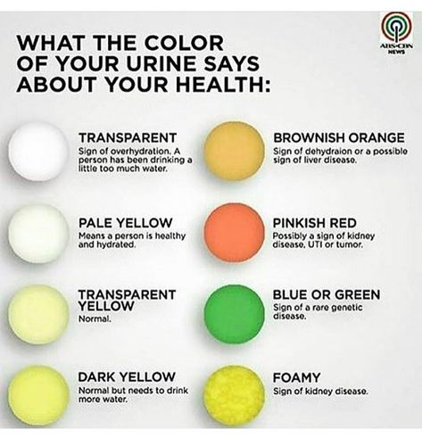 Which one are you???👀 I'm between pale & transparent yellow 💪🏽👏🏽✔️💦👌🏽🔃 #DRINKMOREH20 Green Urine, Pee Color, Color Of Urine, Urine Color, Medical Facts, Nursing School Tips, Nursing School Notes, Medical Anatomy, Medical Laboratory