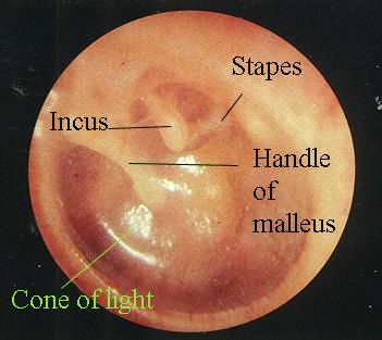 Tympanic Membrane Tympanic Membrane Anatomy, Atlas Anatomy, Tympanic Membrane, Masters In Nursing, Ear Structure, Ear Anatomy, Anatomy Images, Neck Surgery, Middle Ear