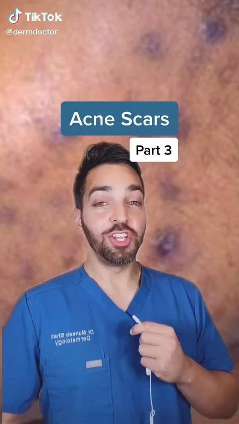 #ColdSoreRemediesThatWork Get Rid Of Scars, Men Skin Care Routine, Natural Face Skin Care, Serious Skin Care, Dermatological Skin Care, Basic Skin Care Routine, Healthy Skin Tips, Facial Skin Care Routine, How To Get Rid Of Acne