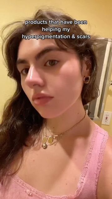 What Works Skin | Acne Community on Instagram: "By using the topical faded and azelaic acid,her hyperpigmentation faded .👌 Credit daveganbeast on tiktok #skincareproducts #skincareroutine #skincare101 #hyperpigmentation #hyperpigmentationtreatment #hyperpigmentationtips" Faded Topicals, Skincare 101, Healthy School, Azelaic Acid, Skin Routine, Increase Engagement, Acne Skin, Green Life, Dry Brushing