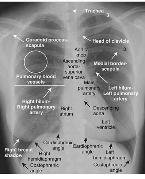 Medical Radiography, Radiology Student, Radiology Imaging, Medical Pictures, Medical Student Study, Medical School Studying, Medical School Essentials, Human Anatomy And Physiology, Medical Imaging