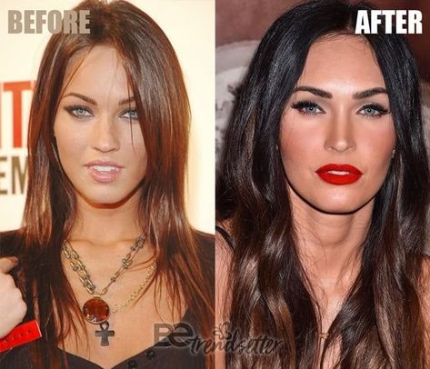 Megan Fox Before Surgery, Megan Fox Lingerie, Megan Fox Face, Body Enhancement, Plastic Surgery Gone Wrong, Megan Denise Fox, Celebrity Plastic Surgery, Botox Fillers, Botox Injections