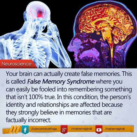 False Memory Syndrome False Memories, Plica Syndrome Exercises, Mecfs Awareness, False Memory Ocd, Acute Flaccid Myelitis, Myalgic Encephalitis Symptoms, Tell Me Something Good, Neuroscience, Physical Health